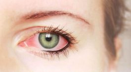 روش های جلوگیری از حساسیت به لوازم آرایشی